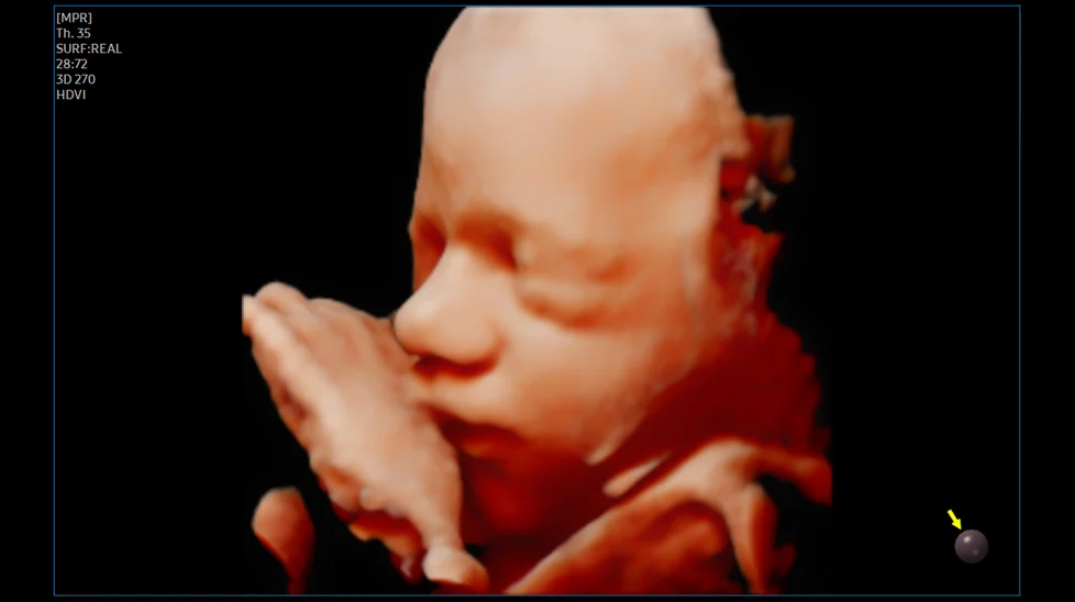 fetales-gesicht-mit-realisticvue