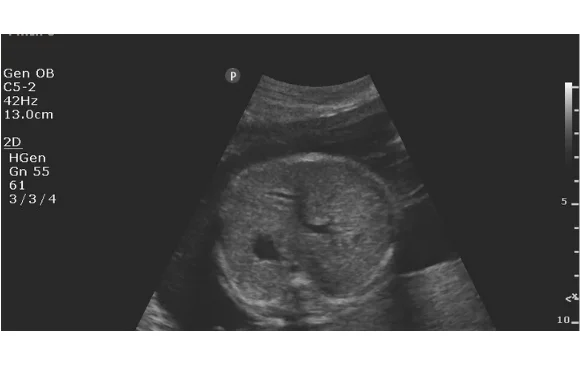 abdomen-ultraschallbild