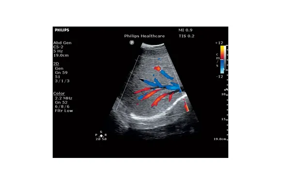 abdomen-ultraschalluntersuchung_ergebnis