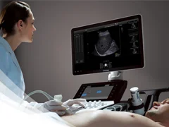 4D Ultraschallgeräte ermöglichen Ihnen eine Betrachtung des ungeborenen Kindes in Echtzeit