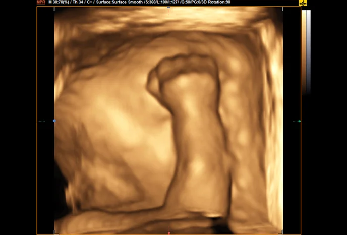 fetale-hand-3d-drittes-trimester