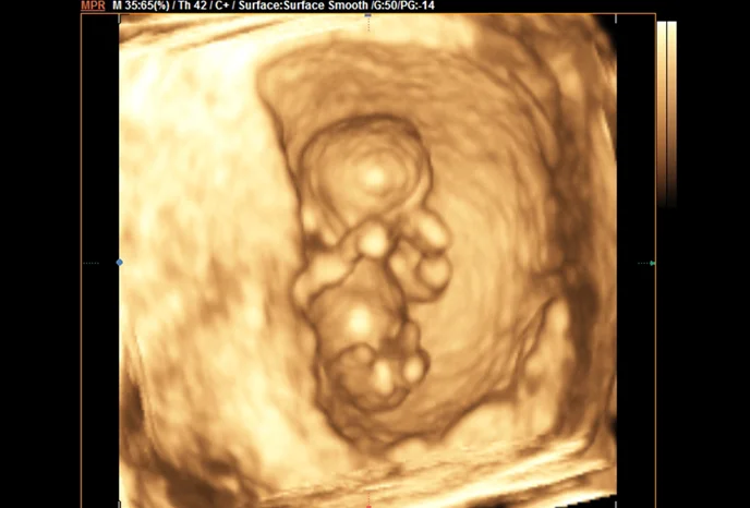 foetus-3d-erstes-trimester