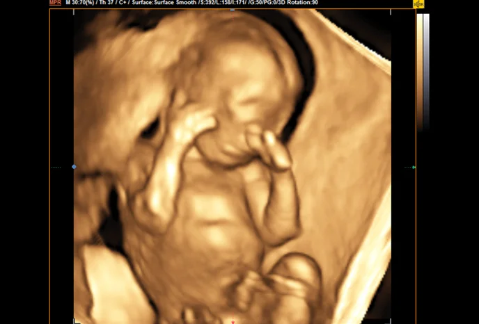 foetus-3d-zweites-trimester