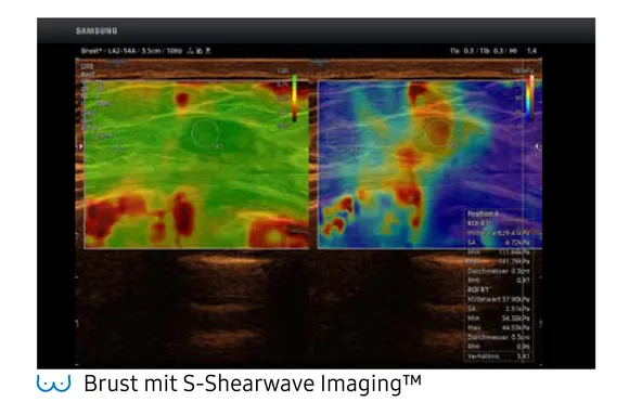 Samsung V8- Shaerwave Imaging II